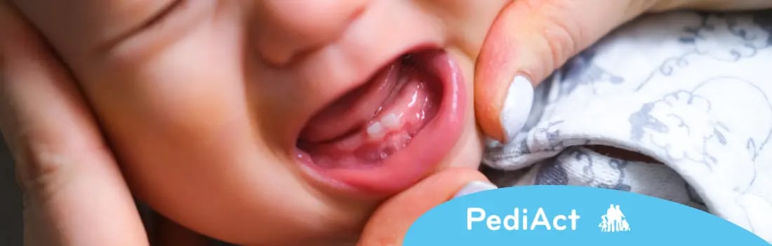 L'apparition des dents de lait de bébé, les conseils de votre